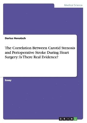 Correlation Between Carotid Stenosis and Perioperative Stroke During Heart Surgery