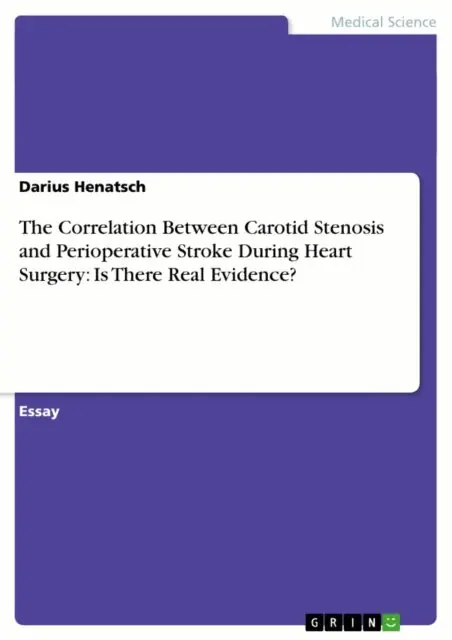 Darius Henatsch - Correlation Between Carotid Stenosis  and Perioperative Stroke During Heart Surgery:  Is There Real Evidence?, E-bok. Tillgänglighet: Lägg i varukorg