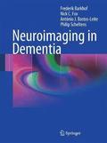 Neuroimaging in Dementia