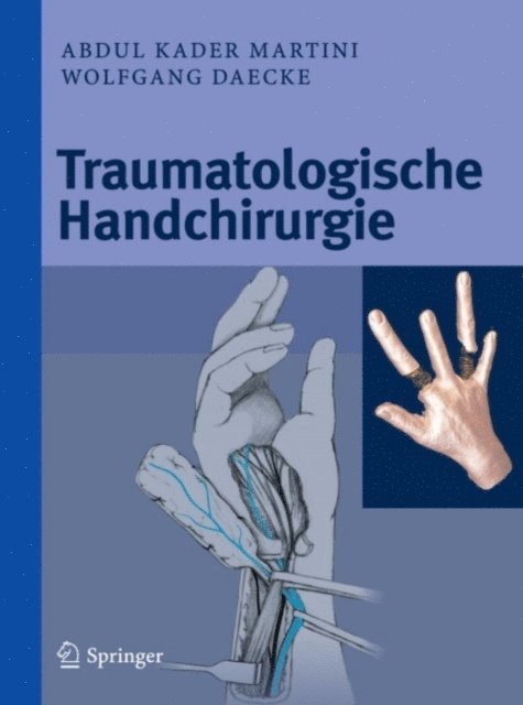 Wolfgang Daecke, Abdul Kader Martini - Traumatologische Handchirurgie, E-bok. Tillgänglighet: Lägg i varukorg