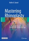 Mastering Rhinoplasty