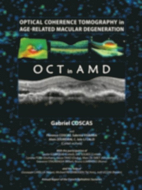 Gabriel Coscas - Optical Coherence Tomography in Age-Related Macular Degeneration, E-bok