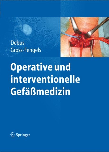Walter Gross-Fengels, Eike Sebastian Debus - Operative und interventionelle Gefäßmedizin, E-bok