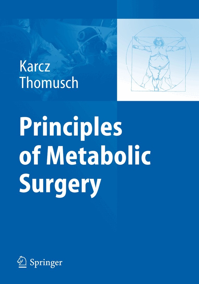 Konrad Karcz, Oliver Thomusch - Principles of Metabolic Surgery, Inbunden