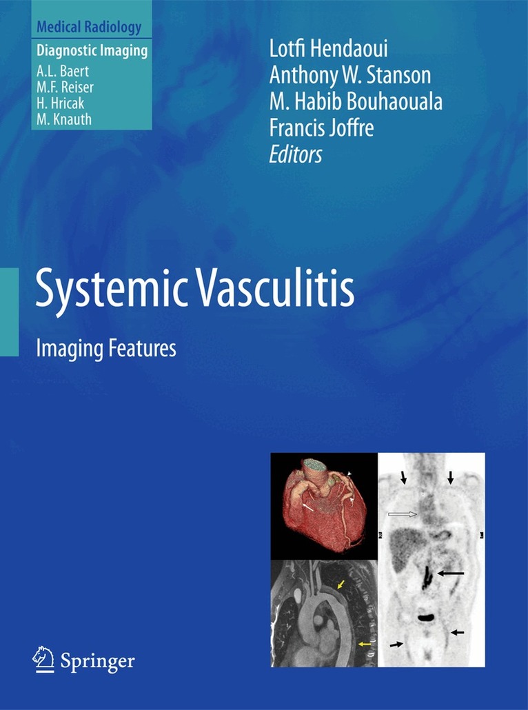 Lotfi Hendaoui, Anthony W. Stanson, M. Habib Bouhaouala, Francis Joffre - Systemic Vasculitis, Inbunden