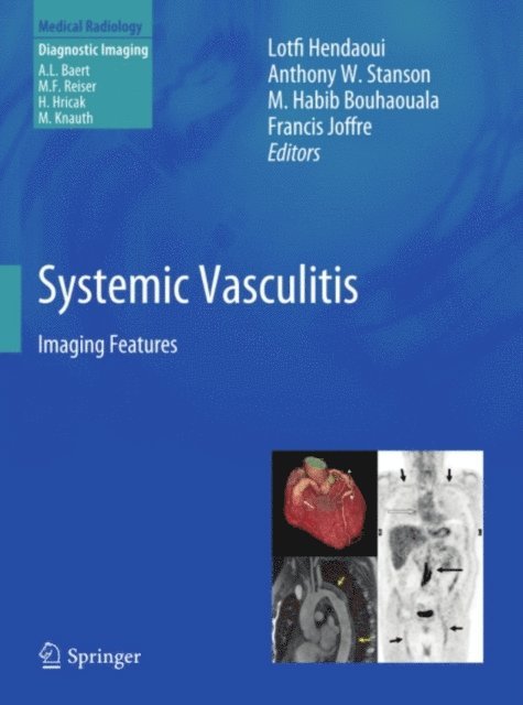 Francis Joffre, M. Habib Bouhaouala, Anthony W. Stanson, Lotfi Hendaoui - Systemic Vasculitis, E-bok