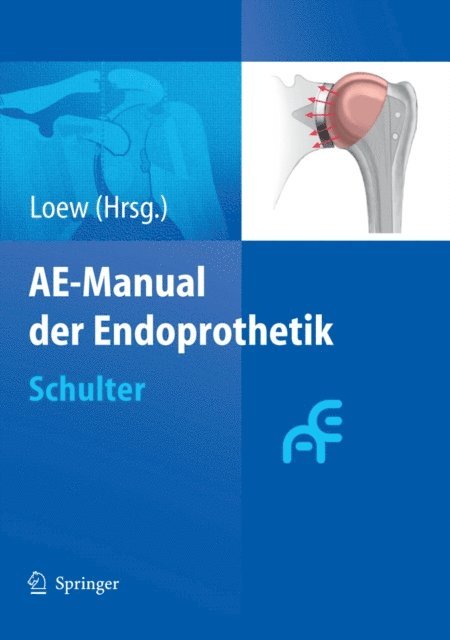 Markus Loew - AE-Manual der Endoprothetik, E-bok