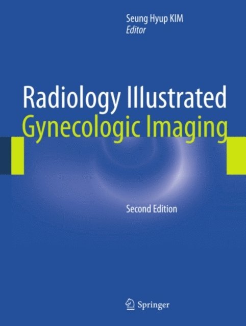 Seung Hyup Kim - Radiology Illustrated: Gynecologic Imaging, E-bok