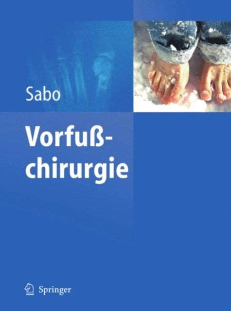 Desiderius Sabo - Vorfußchirurgie, E-bok