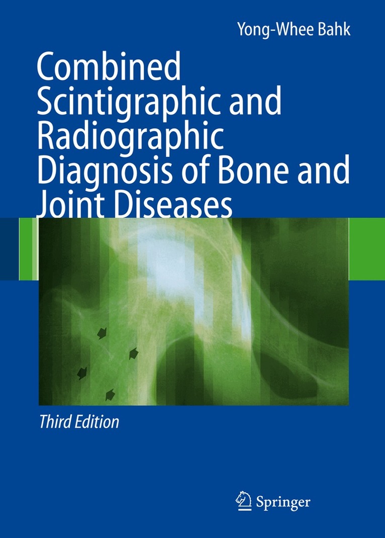 Yong-Whee Bahk - Combined Scintigraphic and Radiographic Diagnosis of Bone and Joint Diseases, Häftad