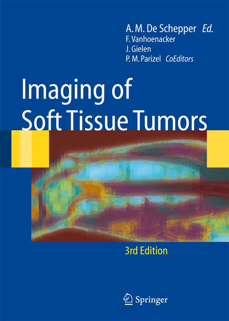 Arthur M. de Schepper - Imaging of Soft Tissue Tumors, Häftad