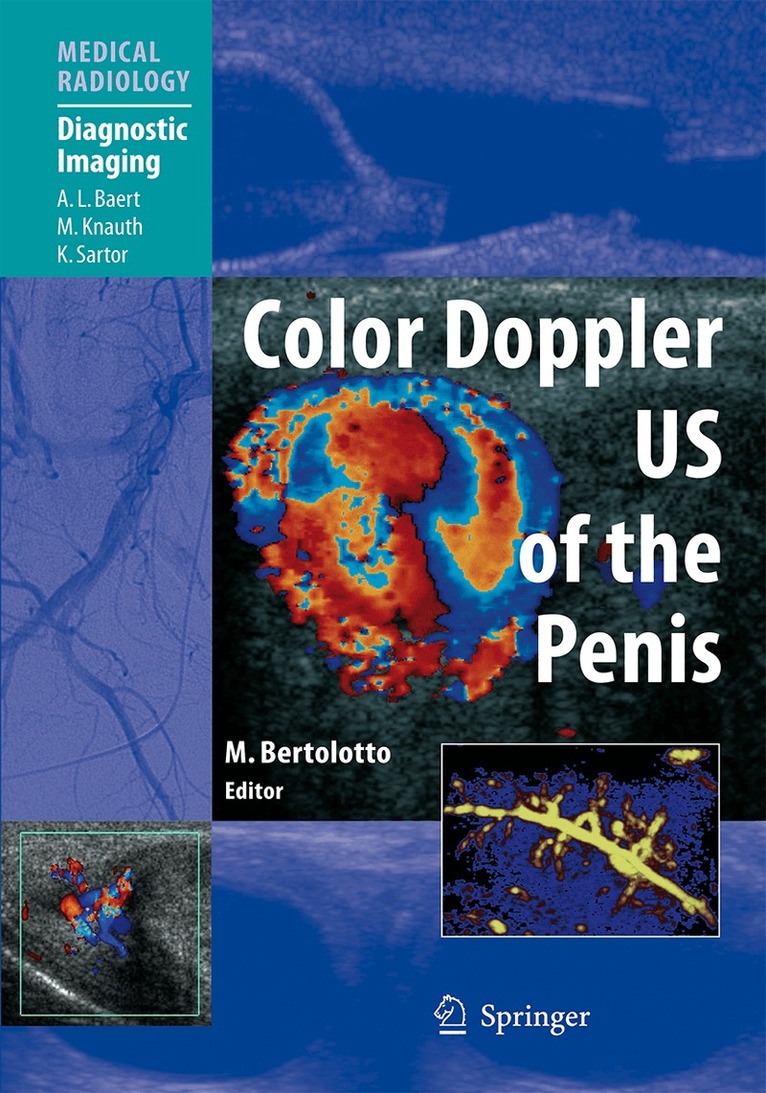 Michele Bertolotto, Michele Bertolotto - Color Doppler US of the Penis, Häftad. Tillgänglighet: Lägg i varukorg