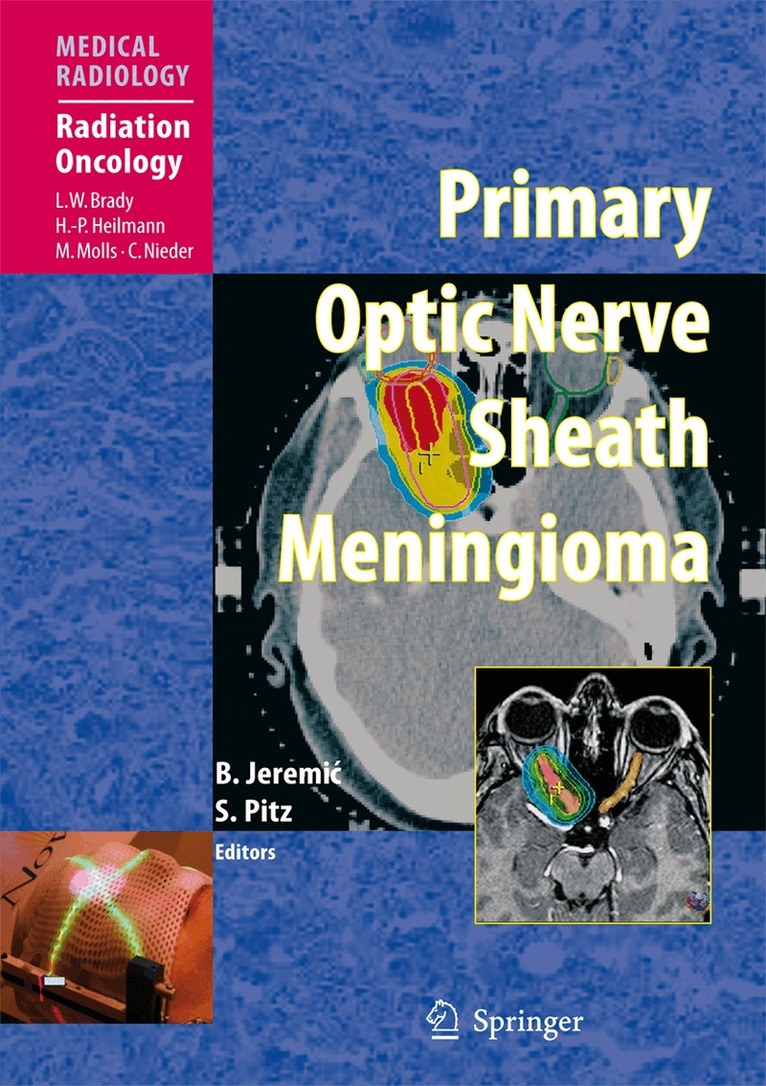 Branislav Jeremic, Susanne Pitz - Primary Optic Nerve Sheath Meningioma, Häftad