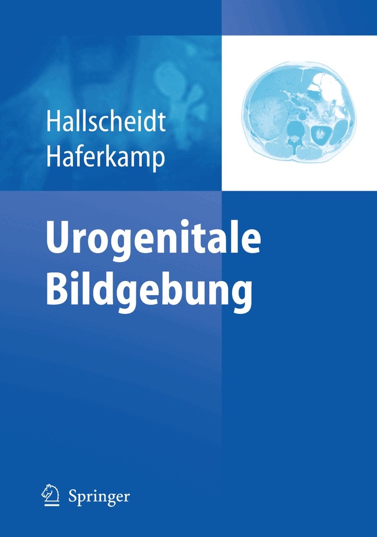 Peter Hallscheidt, Axel Haferkamp - Urogenitale Bildgebung, Inbunden