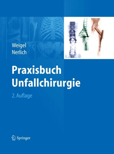 Michael L. Nerlich, Bernhard Weigel - Praxisbuch Unfallchirurgie, E-bok