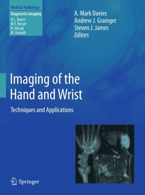 Steven J. James, Andrew J. Grainger, A. Mark Davies - Imaging of the Hand and Wrist, E-bok