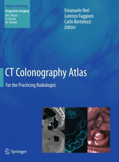 Carlo Bartolozzi, Lorenzo Faggioni, Emanuele Neri - CT Colonography Atlas, E-bok