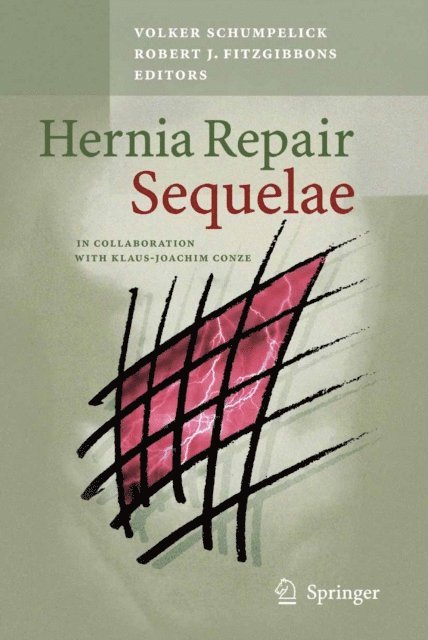 Robert J. Fitzgibbons, Volker Schumpelick - Hernia Repair Sequelae, E-bok