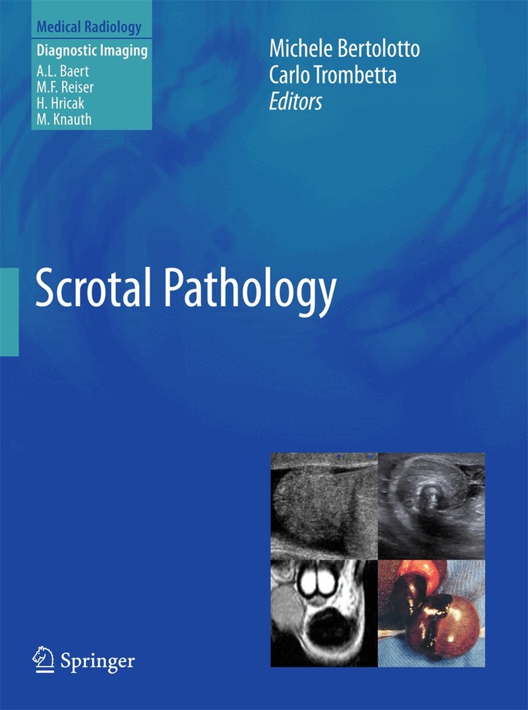 Michele Bertolotto, Carlo Trombetta - Scrotal Pathology, Inbunden. Tillgänglighet: Lägg i varukorg
