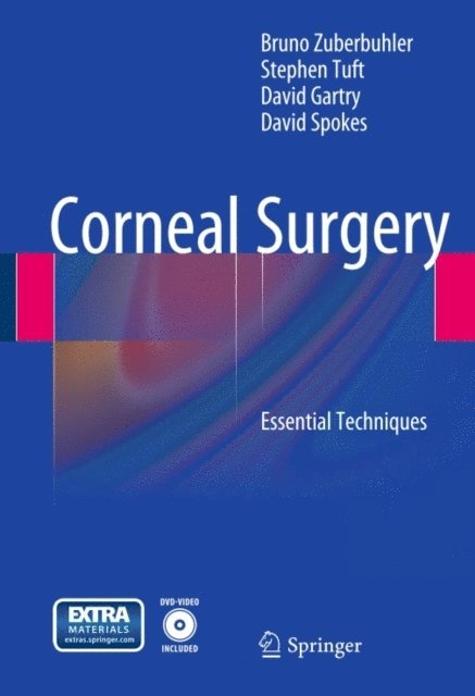 David Spokes, David Gartry, Stephen Tuft, Bruno Zuberbuhler - Corneal Surgery, E-bok