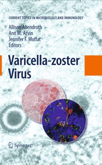 Jennifer F. Moffat, Ann M. Arvin, Allison Abendroth - Varicella-zoster Virus, E-bok