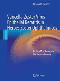 Adenovirus Epithelial Keratitis and Thygeson's Superficial 