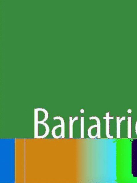 Michael Korenkov - Bariatric Surgery, E-bok