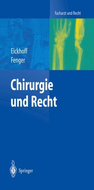 Hermann Fenger, Ulrich Eickhoff - Chirurgie und Recht, E-bok