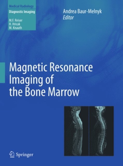 Andrea Baur-Melnyk - Magnetic Resonance Imaging of the Bone Marrow, E-bok