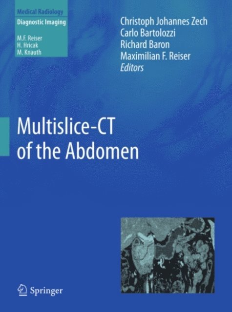 Maximilian F. Reiser, Richard Baron, Carlo Bartolozzi, Christoph Johannes Zech - Multislice-CT of the Abdomen, E-bok