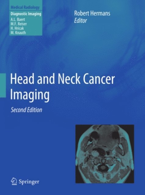 Robert Hermans - Head and Neck Cancer Imaging, E-bok