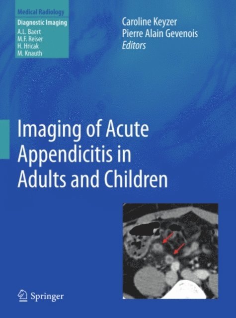 Pierre Alain Gevenois, Caroline KEYZER - Imaging of Acute Appendicitis in Adults and Children, E-bok