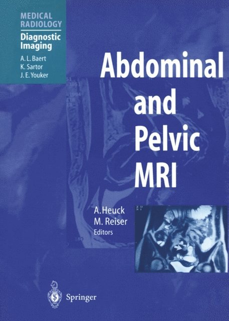 M. Reiser, A. Heuck - Abdominal and Pelvic MRI, E-bok