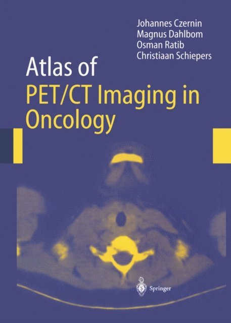Christiaan Schiepers, O. Ratib, Magnus Dahlbom, Johannes Czernin - Atlas of PET/CT Imaging in Oncology, E-bok