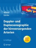 Doppler- und Duplexsonographie der hirnversorgenden Arterien