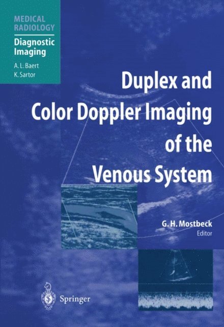 Gerhard H. Mostbeck - Duplex and Color Doppler Imaging of the Venous System, E-bok
