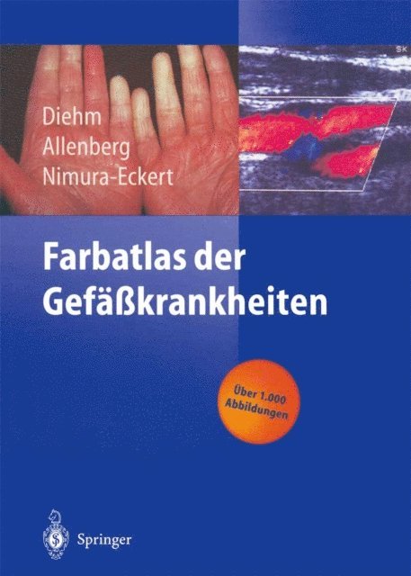 Keiko Nimura-Eckert, J.-R. Allenberg, Curt Diehm - Farbatlas der Gefäßkrankheiten, E-bok