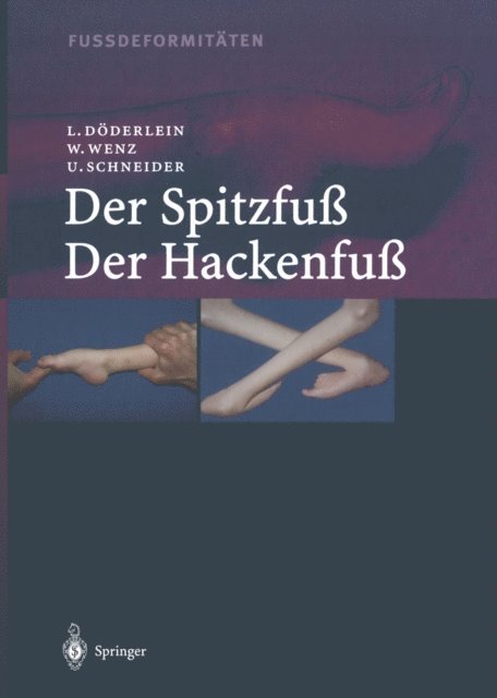 Urs Schneider, Wolfram Wenz, Leonhard Doderlein - Fussdeformitäten, E-bok