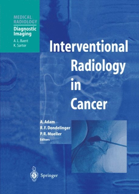 Peter R. Mueller, Robert F. Dondelinger, Andreas Adam - Interventional Radiology in Cancer, E-bok