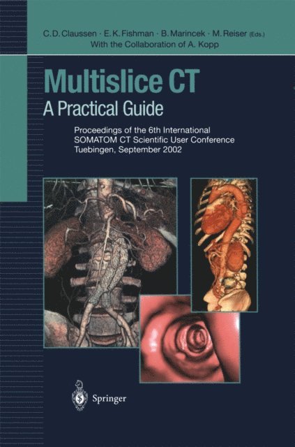 M. Reiser, B. Marincek, E.K. Fishman, Claus D. Claussen - Multislice CT, E-bok