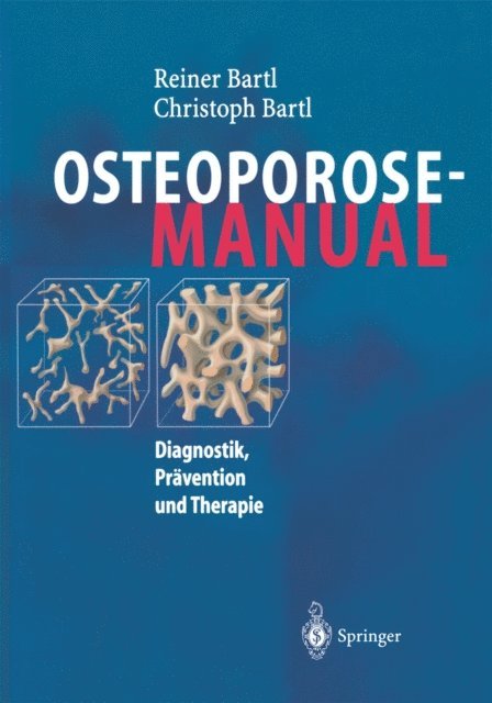 Christoph Bartl, Reiner Bartl - Osteoporose-Manual, E-bok