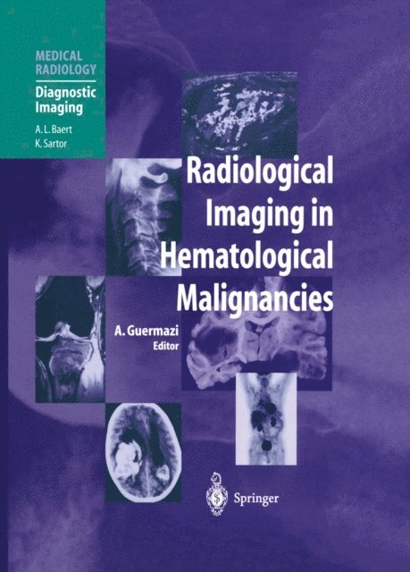 Ali Guermazi - Radiological Imaging in Hematological Malignancies, E-bok
