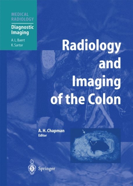 Anthony H. Chapman - Radiology and Imaging of the Colon, E-bok