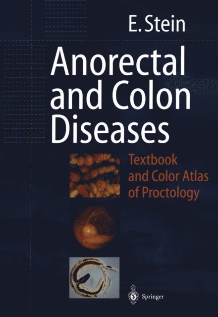 E. Stein - Anorectal and Colon Diseases, E-bok