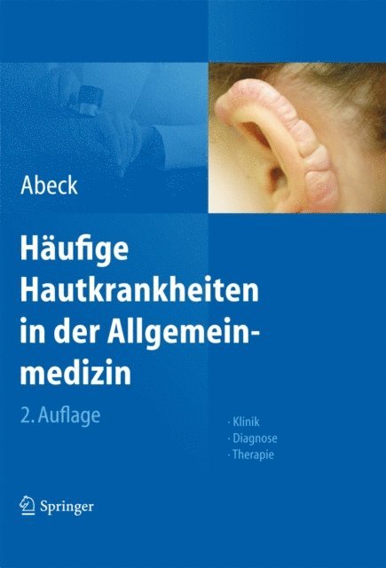 Dietrich Abeck - Häufige Hautkrankheiten in der Allgemeinmedizin, E-bok