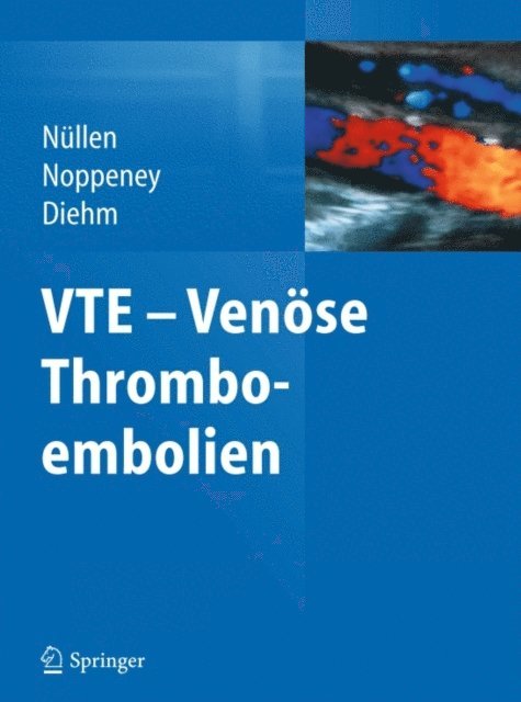 Curt Diehm, Thomas Noppeney, Helmut Nullen - VTE - Venöse Thromboembolien, E-bok