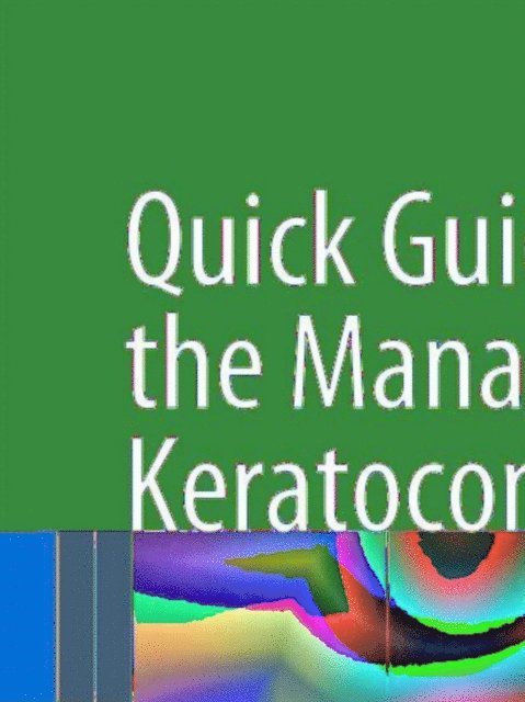 Mazen M. Sinjab - Quick Guide to the Management of Keratoconus, E-bok
