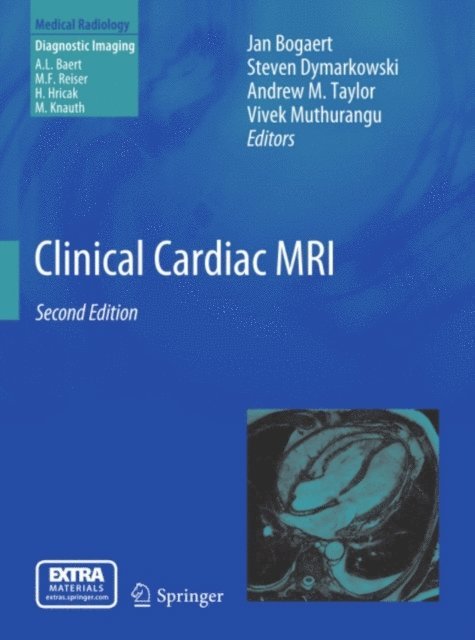 Vivek Muthurangu, Andrew M. Taylor, Steven Dymarkowski, Jan Bogaert - Clinical Cardiac MRI, E-bok
