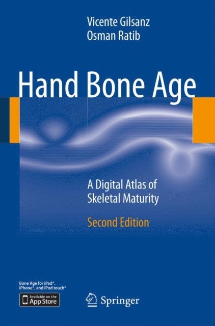 Osman Ratib, Vicente Gilsanz - Hand Bone Age, E-bok