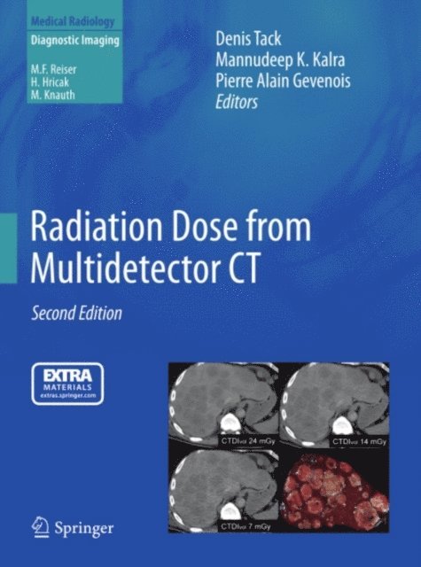 Pierre Alain Gevenois, Mannudeep K. Kalra, Denis Tack - Radiation Dose from Multidetector CT, E-bok